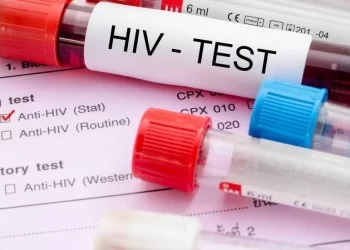 HIV şüphesi veya tanısı olan her bireyin sağlık sistemine güvenle erişim hakkı sağlanmalı