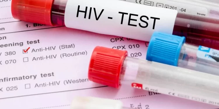 HIV şüphesi veya tanısı olan her bireyin sağlık sistemine güvenle erişim hakkı sağlanmalı